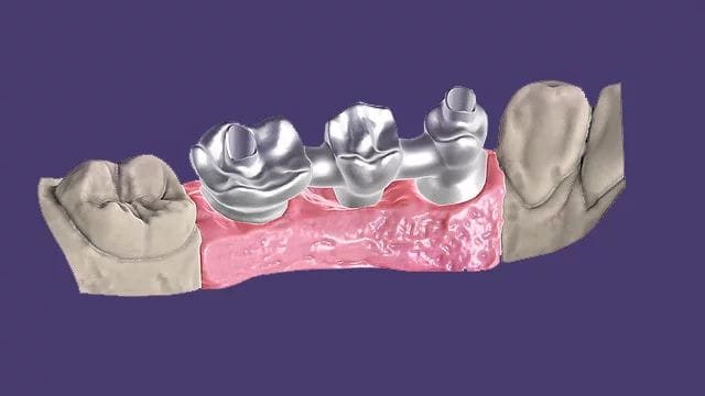 Exocad DentalCAD Implant Lab Bundle