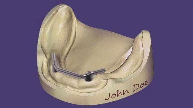 Exocad DentalCAD Implant Lab Bundle