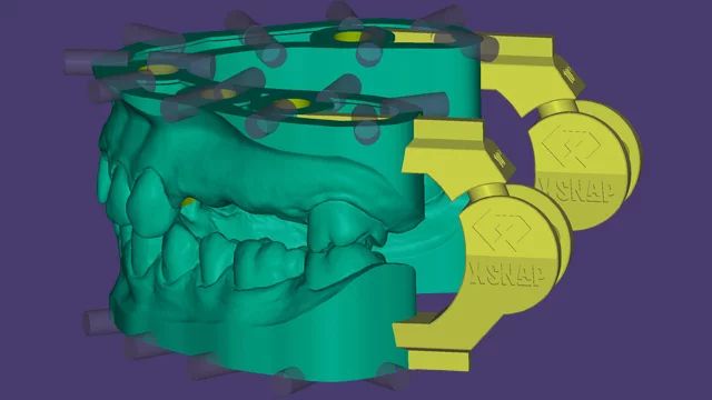 Exocad DentalCAD Ultimate Lab Bundle