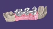 Exocad DentalCAD Ultimate Lab Bundle