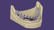 Exocad DentalCAD Ultimate Lab Bundle