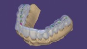 Exocad DentalCAD Ultimate Lab Bundle