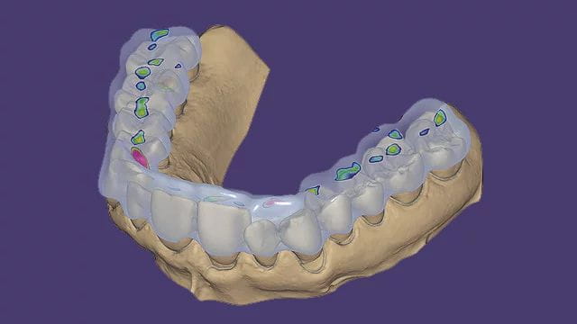 Exocad DentalCAD Ultimate Lab Bundle