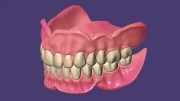 Exocad DentalCAD Ultimate Lab Bundle