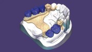 Exocad DentalCAD Ultimate Lab Bundle