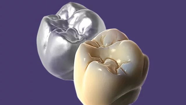 Exocad DentalCAD Ultimate Lab Bundle