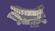 Exocad DentalCAD Ultimate Lab Bundle