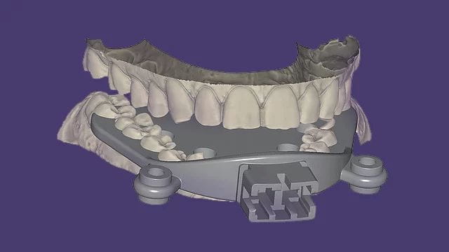 Exocad DentalCAD Ultimate Lab Bundle