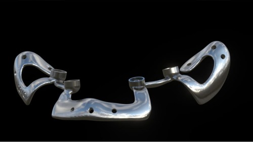Bone Easy - Implant hybrydowy - Rehabilitacja atrofii szczęk