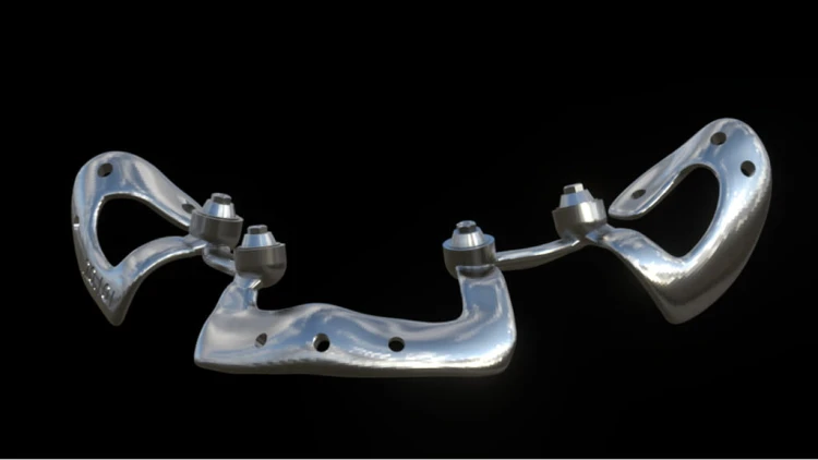 Bone Easy - Implant hybrydowy - Rehabilitacja atrofii szczęk
