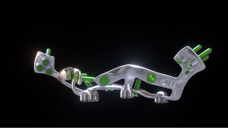 Bone Easy - Implant hybrydowy - Rehabilitacja atrofii szczęk
