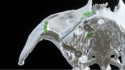 Bone Easy - Implant hybrydowy - Rehabilitacja atrofii szczęk