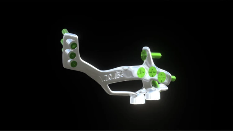 Bone Easy - Implant hybrydowy - Rehabilitacja atrofii szczęk