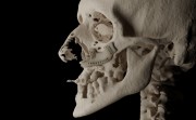 Bone Easy - ICMF - Proteza czaszkowo-szczękowo-twarzowa