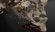 Bone Easy - ICMF - Proteza czaszkowo-szczękowo-twarzowa
