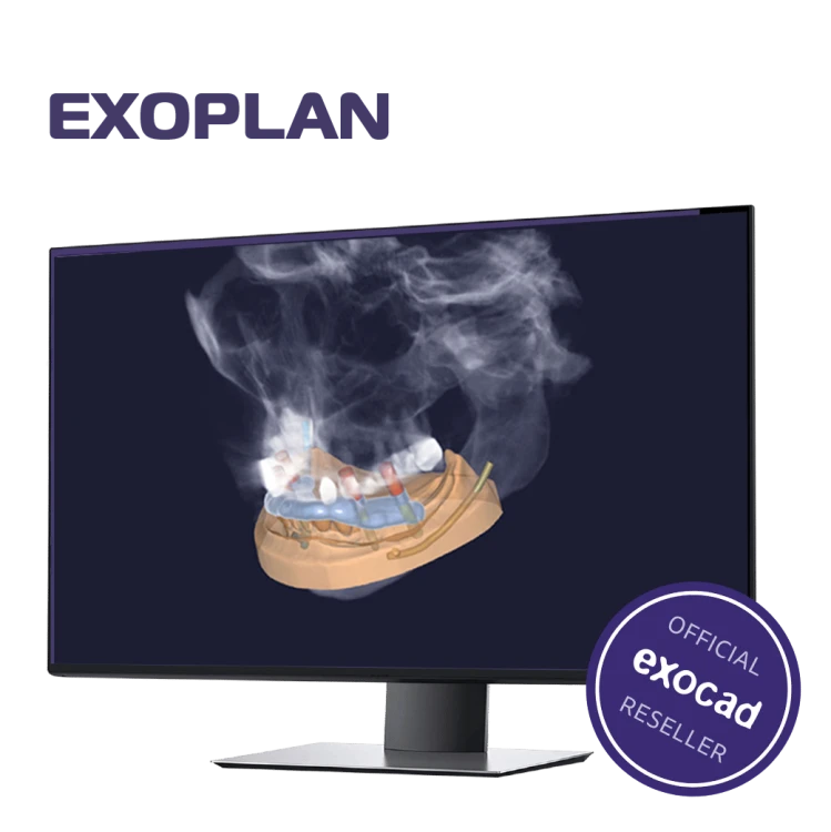 Exoplan