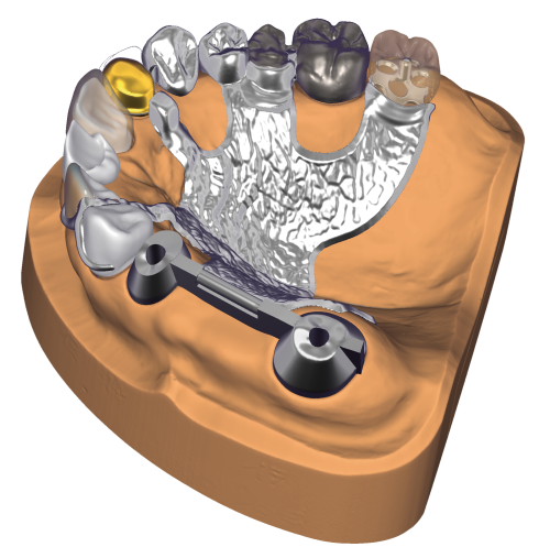DentalCAD_generic_Page_4_Versatile.png