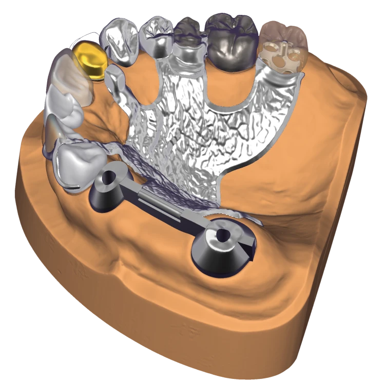 DentalCAD_generic_Page_4_Versatile.png
