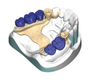 DentalCAD_generic_Page_9_partialCAD.png