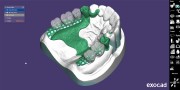 DentalCAD_generic_Page_16_Screen_PartialCAD.png