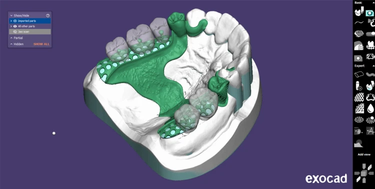 DentalCAD_generic_Page_16_Screen_PartialCAD.png