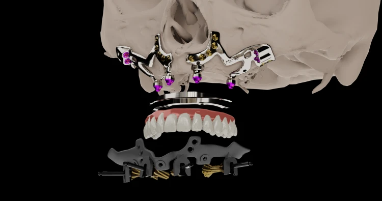 Render01 (Black) główne.png